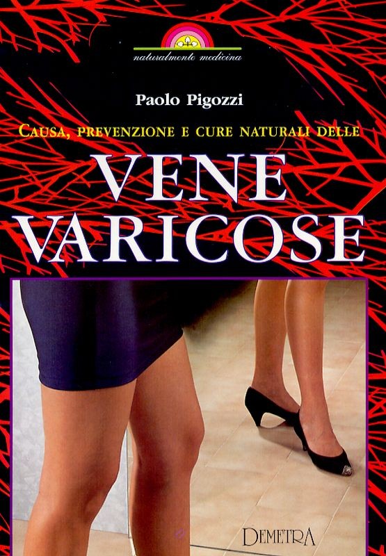 VENE VARICOSE
