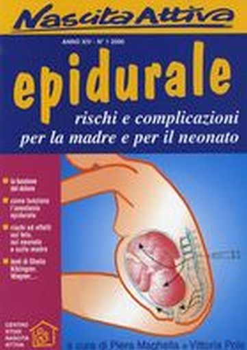 EPIDURALE