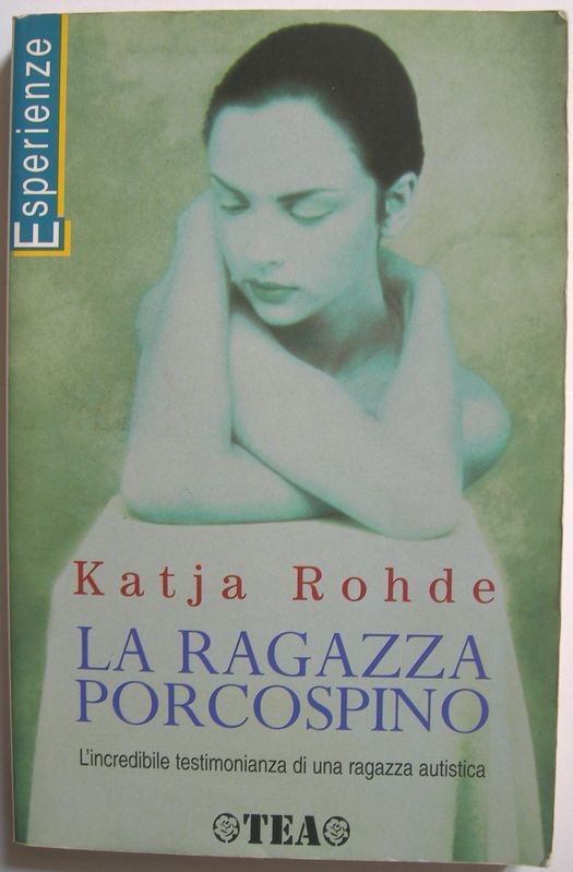 La ragazza porcospino
